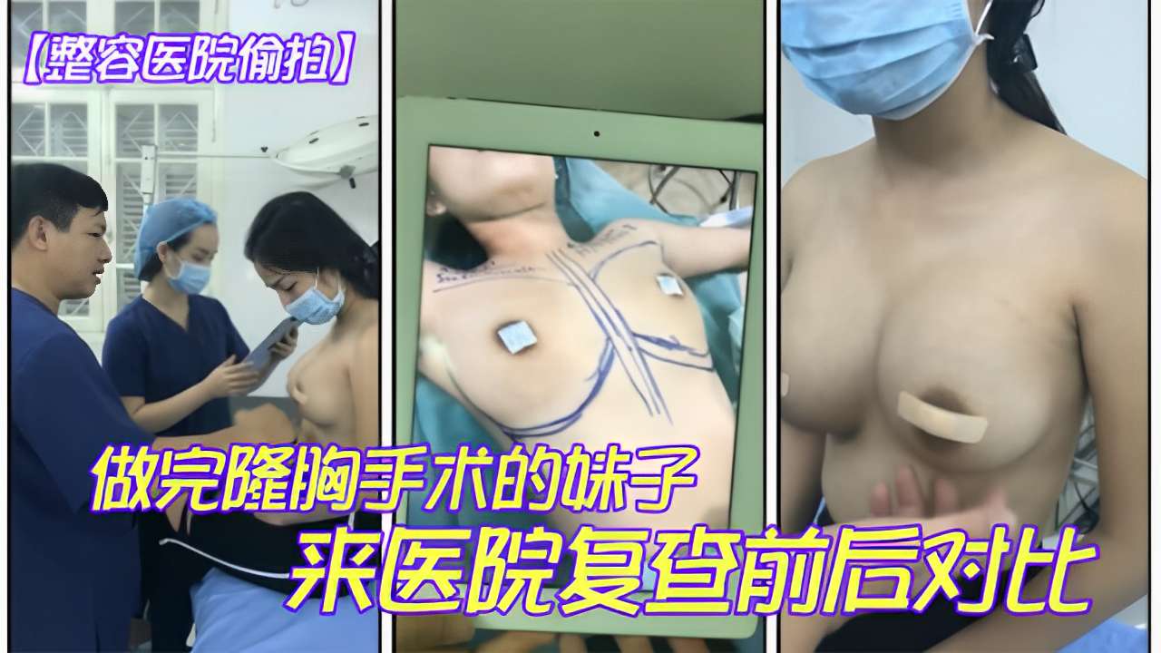 整容医院偷拍做完隆胸手术的咪子来医院复查前后对比封面