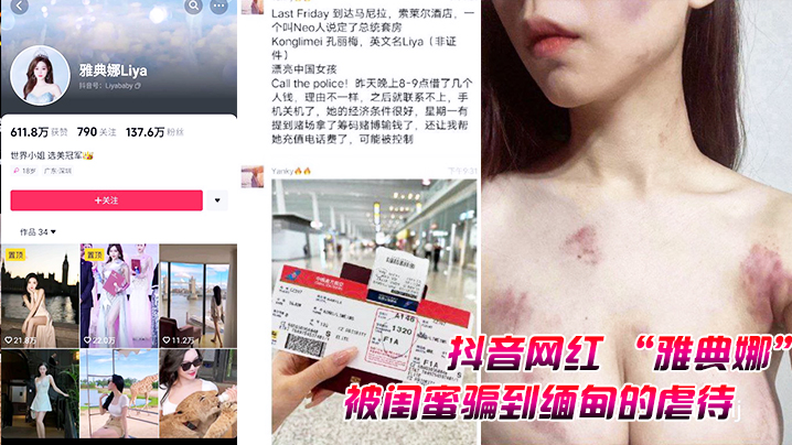 抖音网红雅典娜被闺蜜骗到缅甸的虐待视频曝光封面